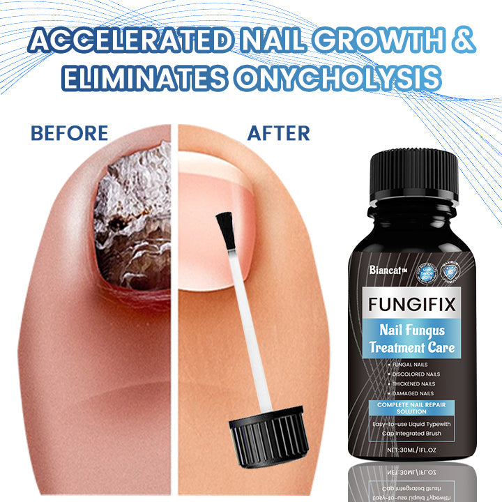 Biancat™ FungiFix Nail Fungus Treatment Care Fluid