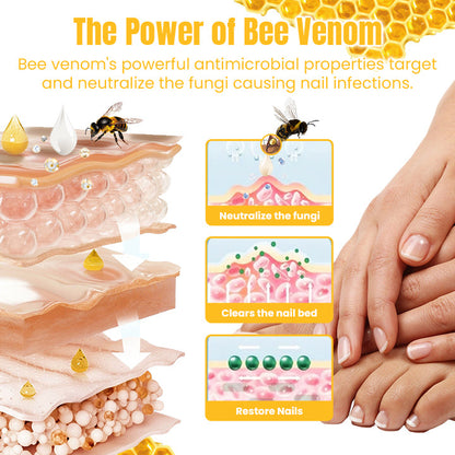 Ceoerty™ FungiGone Bee Venom Nail Cream