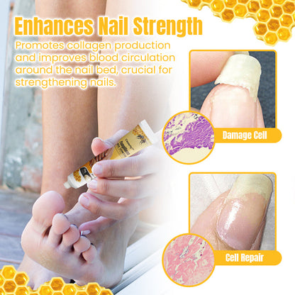 Ceoerty™ FungiGone Bee Venom Nail Cream (US)