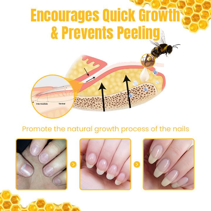 Ceoerty™ FungiGone Bee Venom Nail Cream (US)