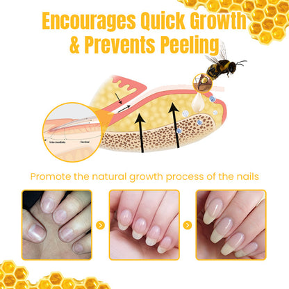 Ceoerty™ FungiGone Bee Venom Nail Cream